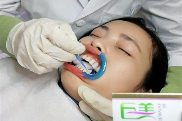 成都(dōu)學美(měi)牙隻為(wèi)開(kāi)店(diàn)